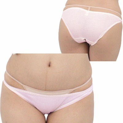 �L�k�����Q�R�b�g���ҊJ���t���o�b�N�@�s���N�i�����W�F���[�j